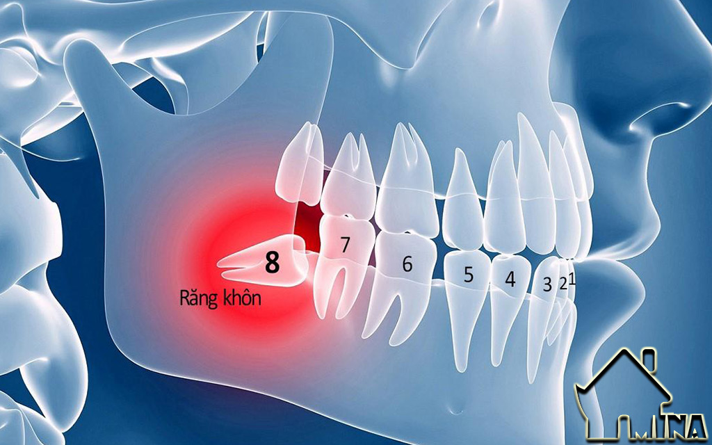Dấu Hiệu Nhận Biết Viêm Xương Ổ Răng